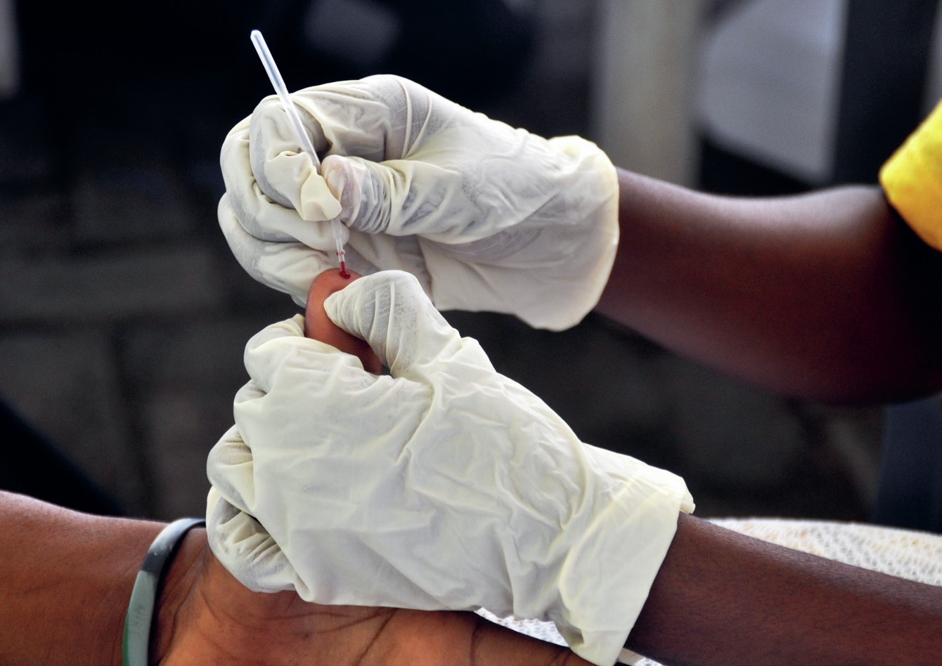 Photograph showing the gloved hands of a health worker drawing blood from the thumb of a patient